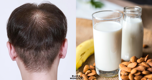 "My hairline getting higher?!" Take a look! They said that these will help to reduce the chance of hair loss!