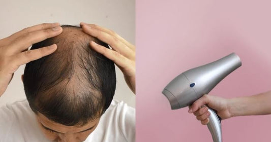 Dealing with hair loss problem? Here, we tell you 3 ways to deal with it!!!