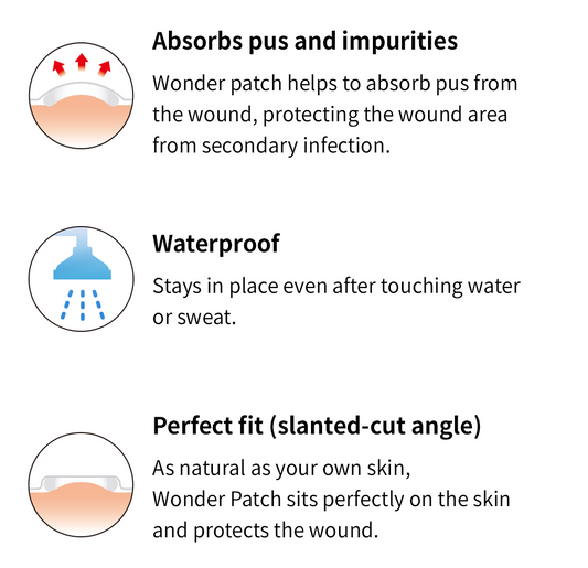 Acne patch (60pcs) | Absorb pus & impurities